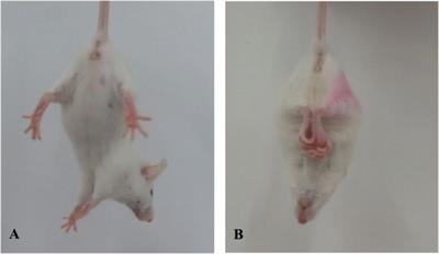 Involvement of CYP2E1 in the Course of Brain Edema Induced by Subacute Poisoning With 1,2-Dichloroethane in Mice